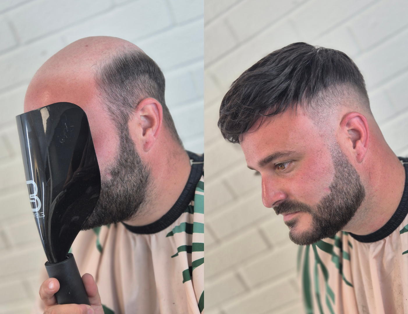 Side profile before and after of a hair system fitting